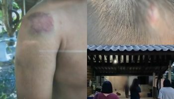 Жители Районга митингуют в поддержку 11-летнего мальчика, над которым издевались его родители