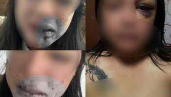 Тайская женщина обратилась за помощью после жестокого нападения бывшего парня