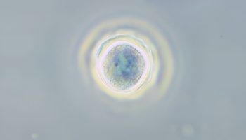 Департамент здравоохранения Таиланда опубликовал предупреждение о росте числа глазных инфекций, вызванных загрязненной водопроводной водой