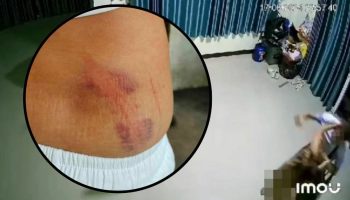 Женщина утверждает, что бойфренд участкового напал на нее, сломал ребра