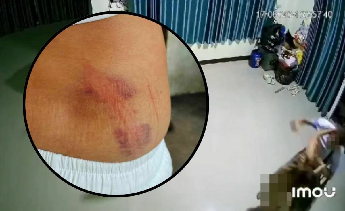 Женщина утверждает, что бойфренд участкового напал на нее, сломал ребра