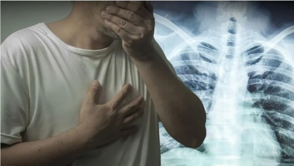 На границе Таиланда и Мьянмы надвигается вспышка туберкулеза