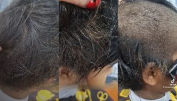 Вши ждут встречи с вами: Ролик TikTok о том, как у девушки волосы встают дыбом, поражает социальные сети