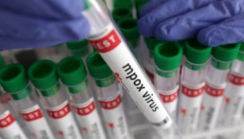 Первый случай выздоровления от нового варианта mpox