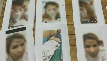 Женщина из Паттайи впала в кому после жестокого нападения бойфренда