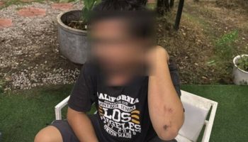 Мужчина из Таиланда, избитый до потери сознания охранниками и туристами в Саттахипе