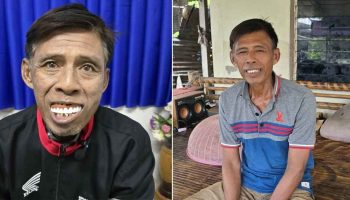 Стоматологическая дилемма диджея: интернет-магазин "кусает в ответ", оставляя его беззубым