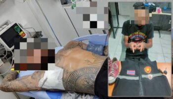 Иностранец госпитализирован после нападения с ножом