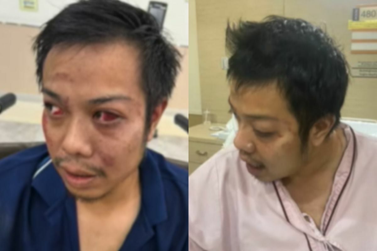 Опознание по ошибке: тайский мужчина получил синяки в результате отрезвляющей ошибки полиции