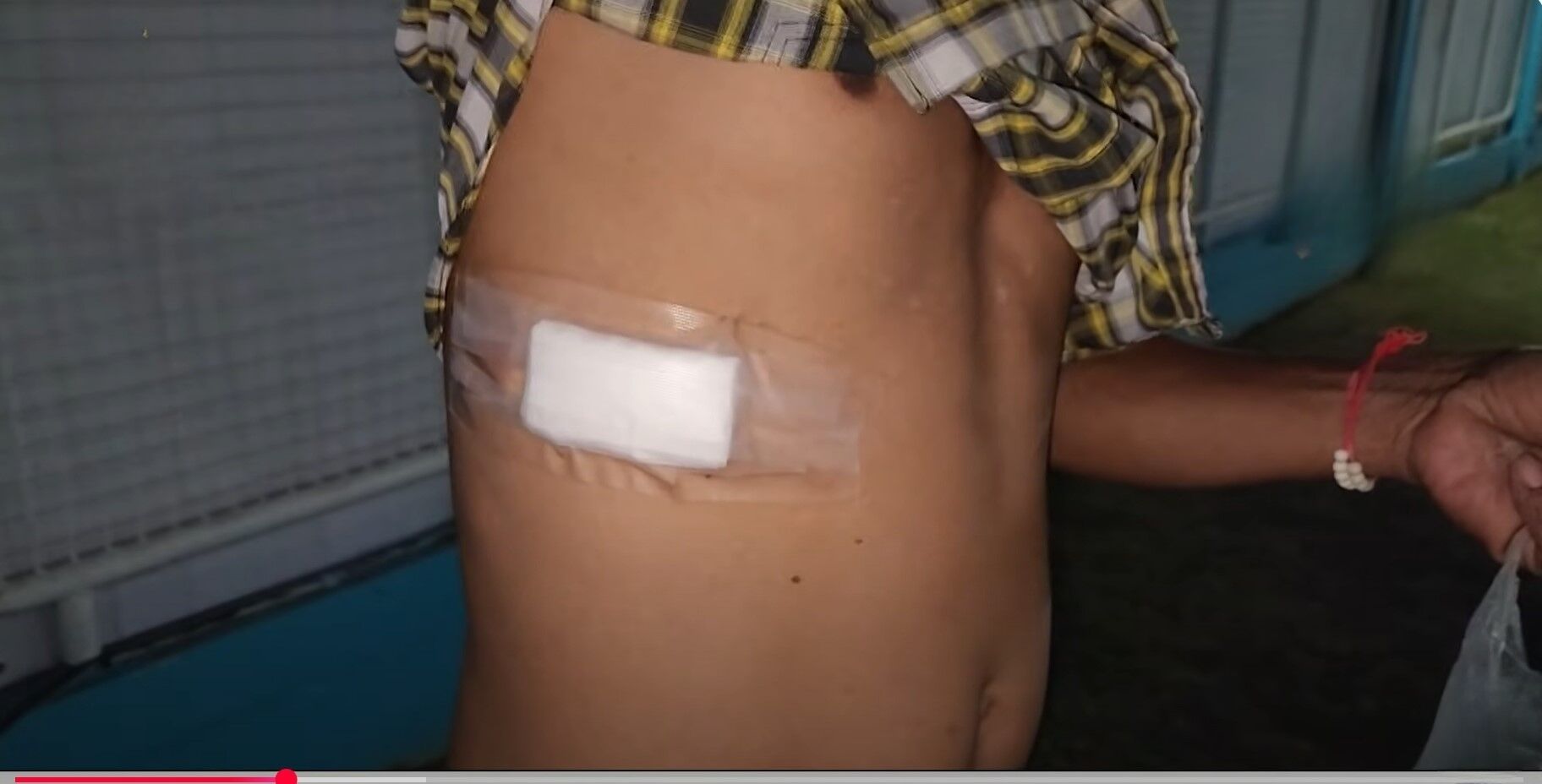 Сисакет: Мужчина спрятался в соседской урне после того, как ударил ножом отца (видео)