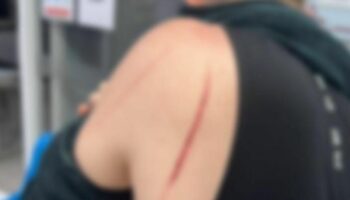 Проблемы с рублем: российского туриста ограбили и избили на Пхукете