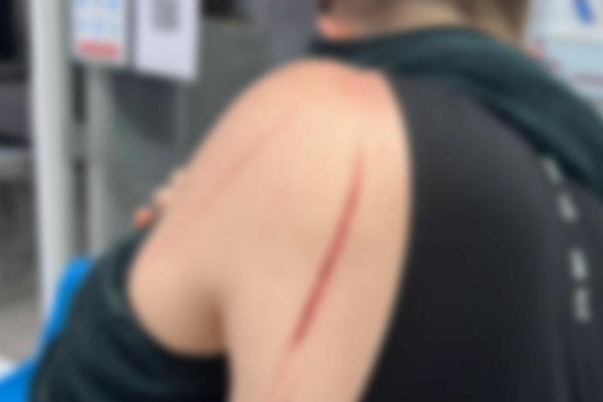 Проблемы с рублем: российского туриста ограбили и избили на Пхукете