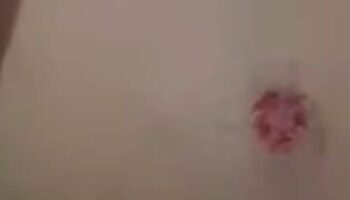 Тайская женщина была ранена шальной пулей во время отдыха в День святого Валентина