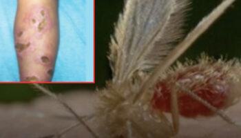 В Таиланде срочно объявили тревогу по поводу случаев смерти от лейшманиоза