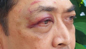 На секретаря SAO в Лопбури совершено нападение, он опасается за свою безопасность