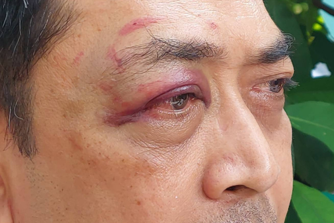 На секретаря SAO в Лопбури совершено нападение, он опасается за свою безопасность