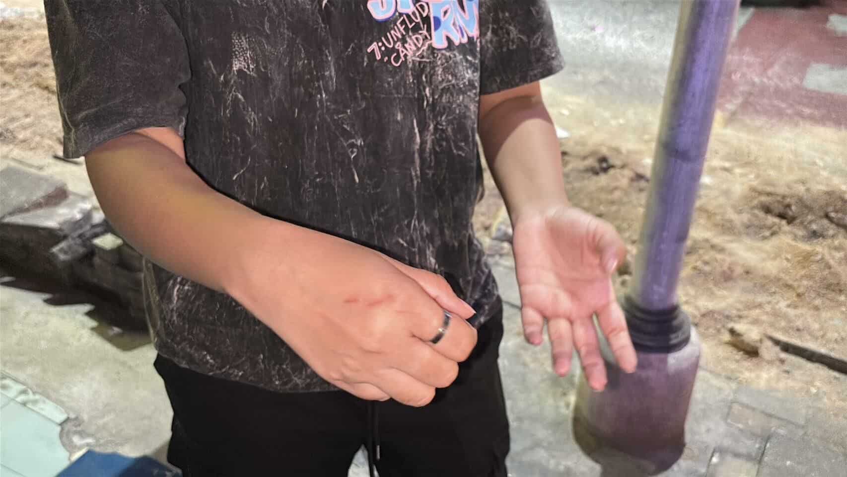 Настоящая драма! Работник магазина каннабиса в Паттайе пострадал в результате ночного нападения