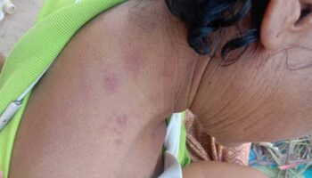 Семья Сисакет добивается справедливости после десяти лет жестокого обращения с сыном