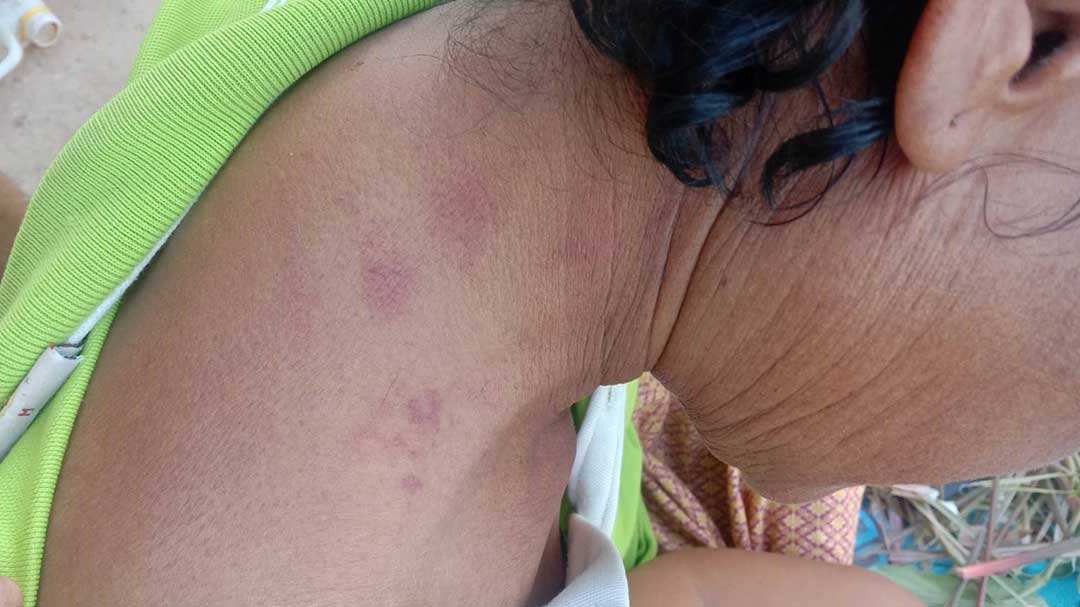 Семья Сисакет добивается справедливости после десяти лет жестокого обращения с сыном