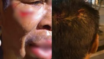 Тайская женщина отрицает жестокое обращение с психически больным мужчиной, несмотря на видимые раны