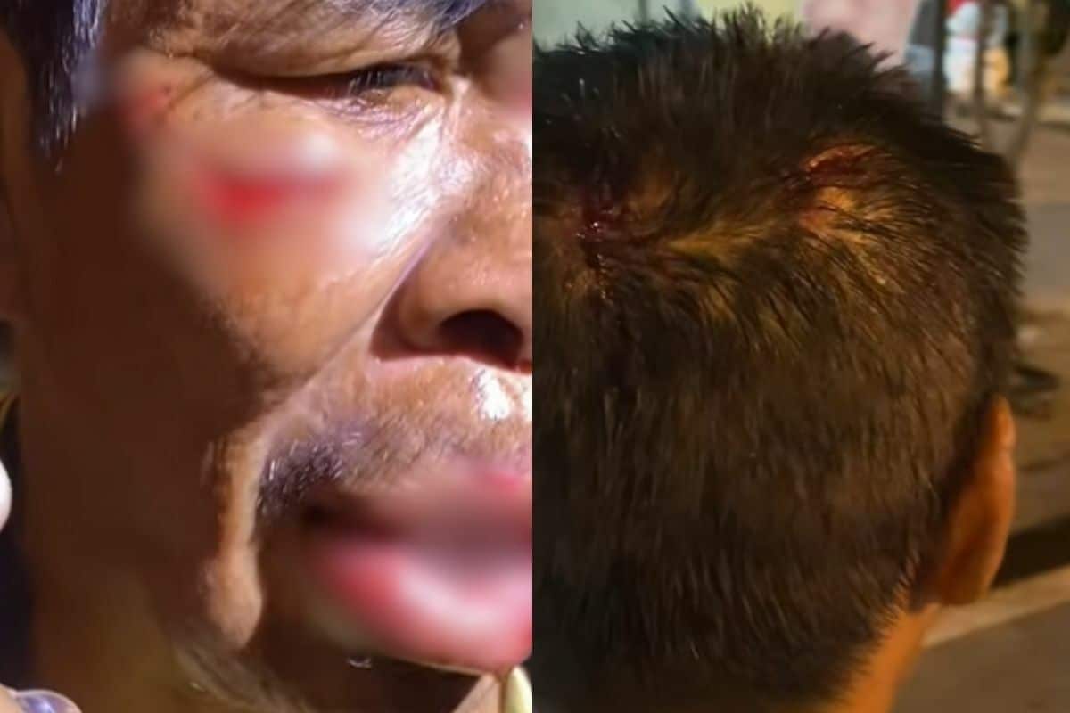 Тайская женщина отрицает жестокое обращение с психически больным мужчиной, несмотря на видимые раны