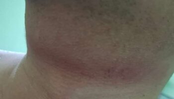 Тайский мужчина был задушен и ограблен во время мочеиспускания на обочине дороги