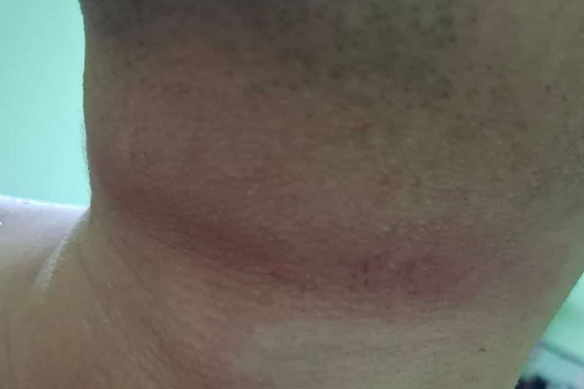 Тайский мужчина был задушен и ограблен во время мочеиспускания на обочине дороги