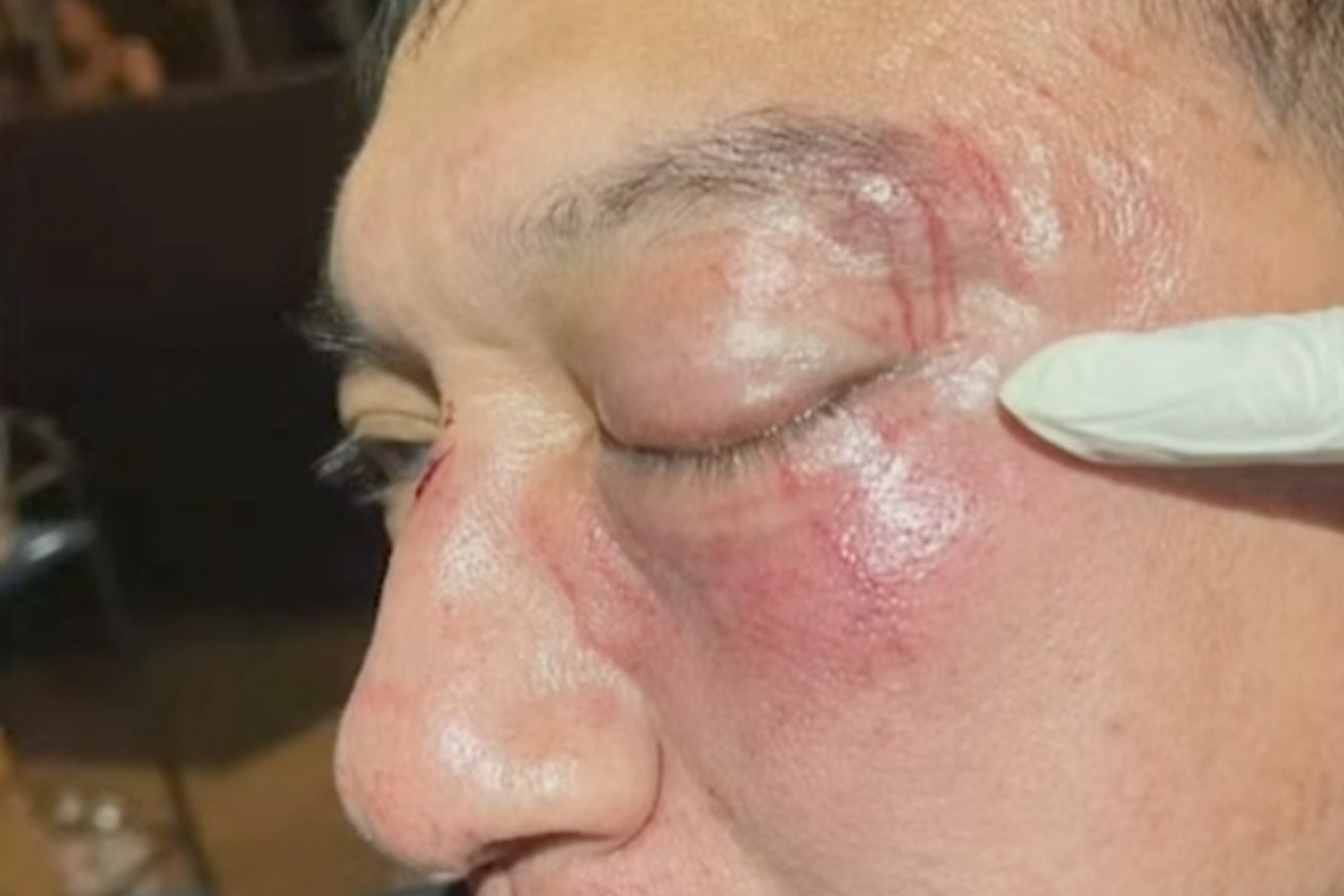 Капитан полиции обвиняется в нападении на певца