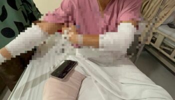 Тайская девчонка-сорванец госпитализирована после того, как водитель седана протаранил ее и напал на нее