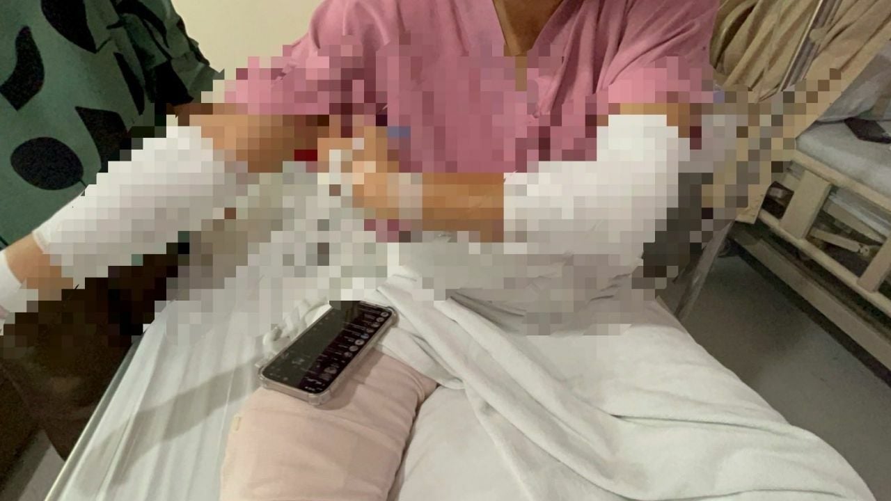 Тайская девчонка-сорванец госпитализирована после того, как водитель седана протаранил ее и напал на нее