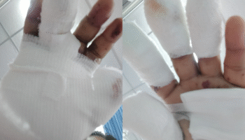 Заслоненные взрывные устройства ранят двоих в Лопбури