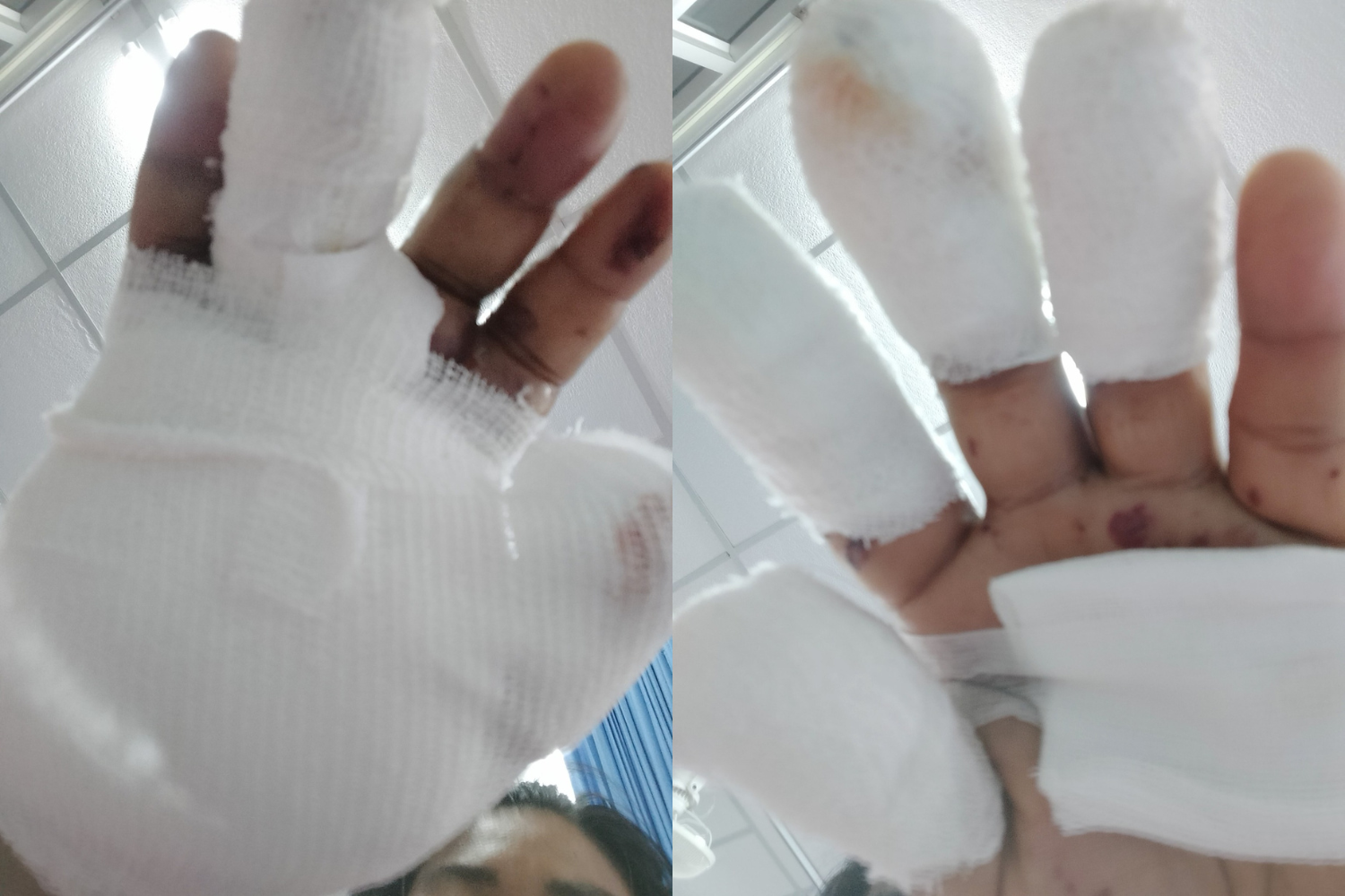 Заслоненные взрывные устройства ранят двоих в Лопбури