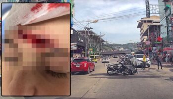 Россиянка госпитализирована после ДТП в Патонге