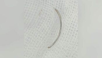 Стоматолог-бурирам оставляет иглу в десне пациента, вызывая страх перед черной магией