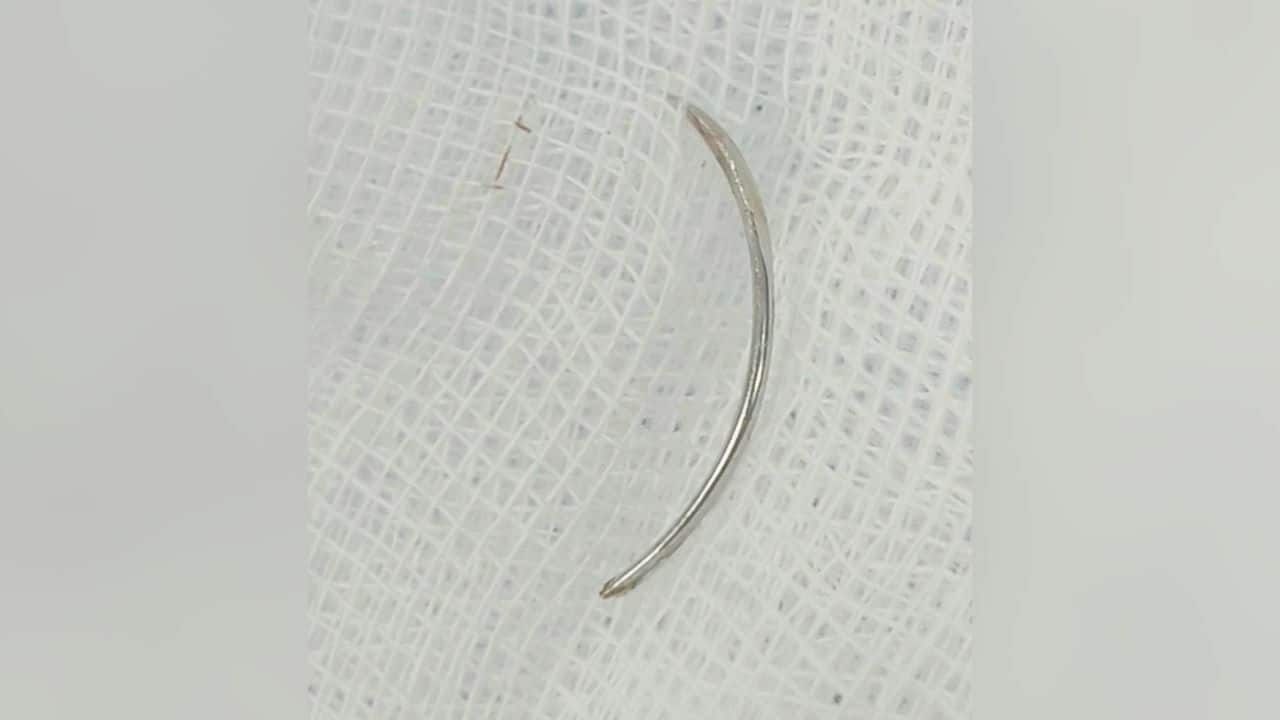 Стоматолог-бурирам оставляет иглу в десне пациента, вызывая страх перед черной магией