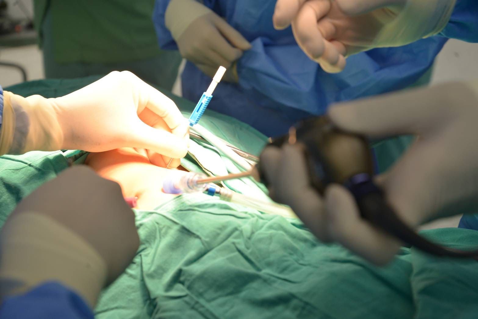 Врачи Бангкока проводят операции для новорожденных без рубцов