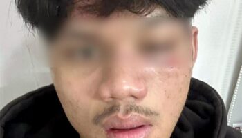 Паттайский подросток жестоко избит бандой с мачете