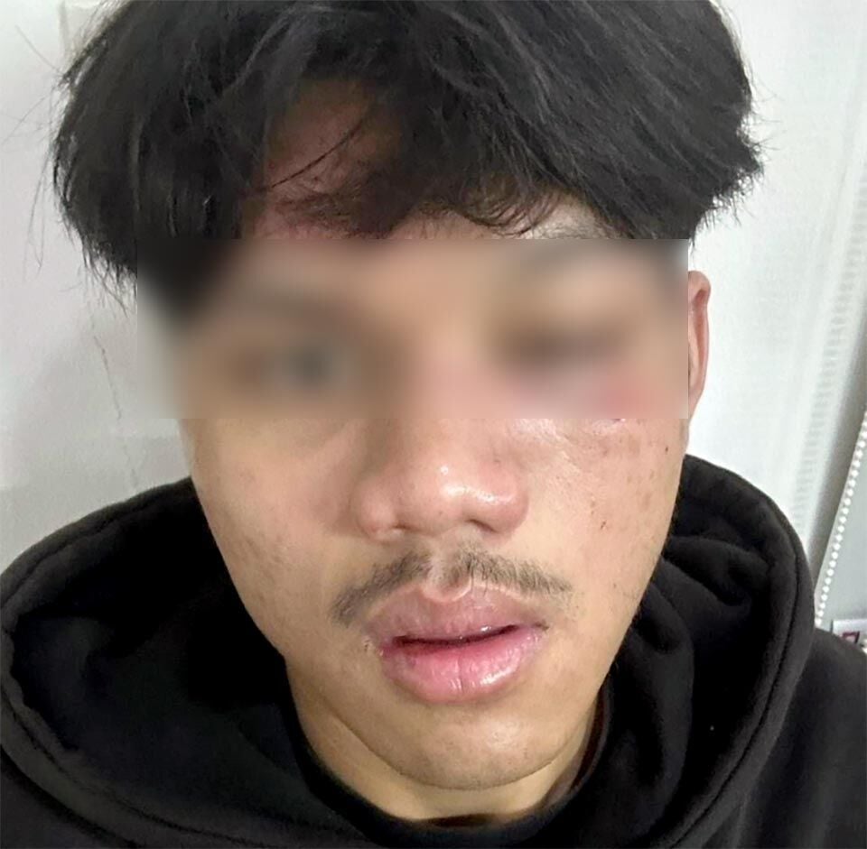 Паттайский подросток жестоко избит бандой с мачете