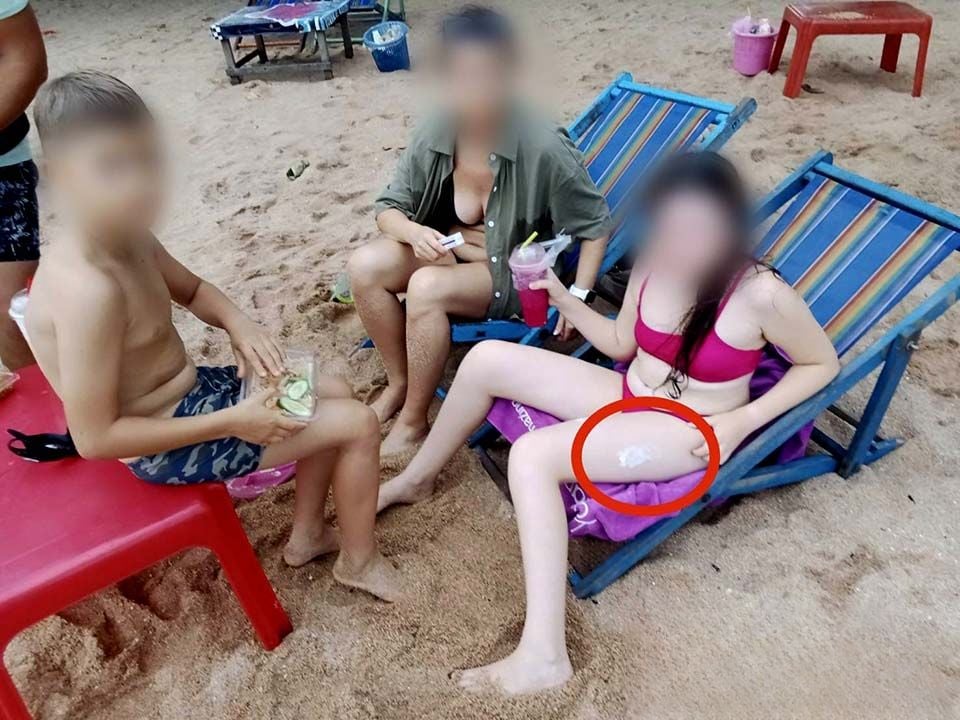 Спасение: Русская девушка уколота иглобрюхом на пляже Джомтьен