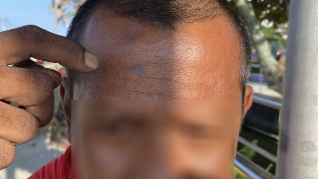 Таиландец allegedly атакует работника доставки и крадет 500 бат у жертвы