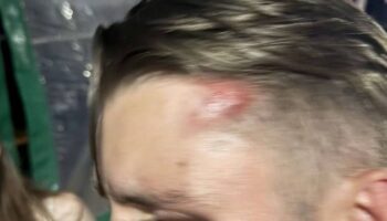 Нидерландские туристы атакованы иностранцами возле гостиницы в Пхукете