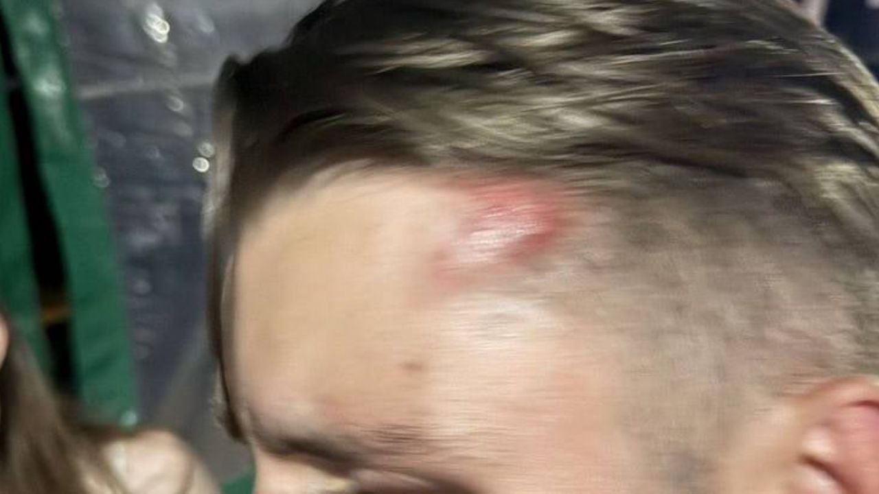 Нидерландские туристы атакованы иностранцами возле гостиницы в Пхукете