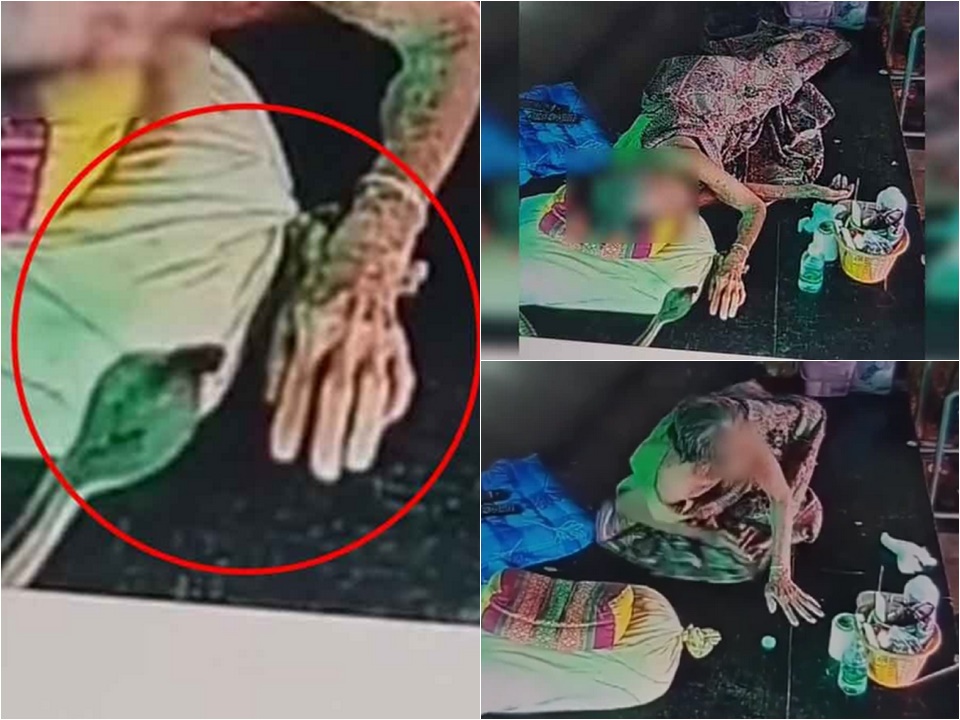 93-летняя женщина, укушенная коброй, отдыхая под своим домом в Пхетчабуне