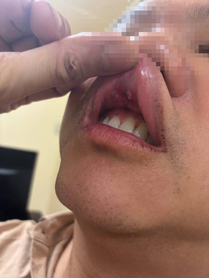 Американский турист knocked out in late-night Pattaya clash