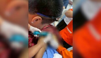 Тайский мужчина запирает член двумя кольцами из-за страха кражи полового члена.