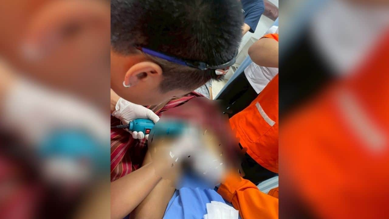 Тайский мужчина запирает член двумя кольцами из-за страха кражи полового члена.