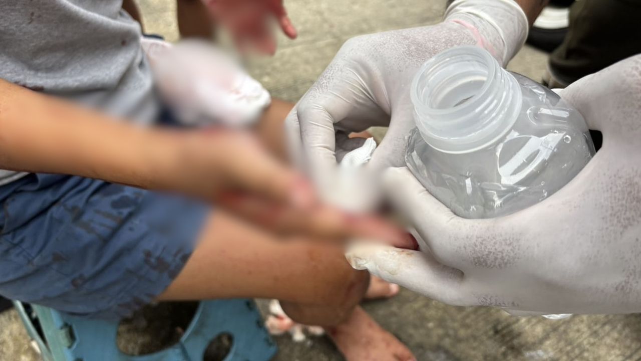 Тайский отец напал на дочь с пилой в доме в Самут Пракане