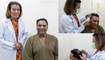 Пересадка волос в Бангкоке при потере волос и облысении