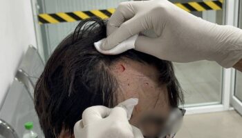 Китайский мужчина подвергся нападению и ограблению со стороны 3 трансженщин в Паттайе