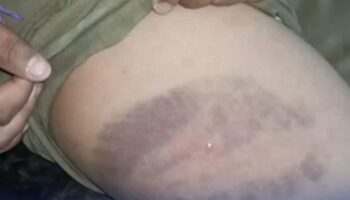 Тайский мальчик найден с синяками после того, как его избила бабушка